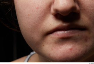 HD Face skin references Chloe Watson lips mouth nose skin…
